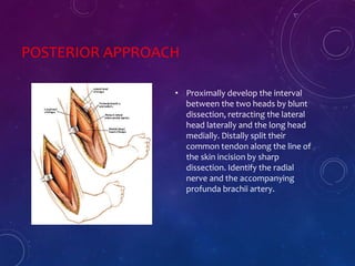 POSTERIOR APPROACH
• Proximally develop the interval
between the two heads by blunt
dissection, retracting the lateral
head laterally and the long head
medially. Distally split their
common tendon along the line of
the skin incision by sharp
dissection. Identify the radial
nerve and the accompanying
profunda brachii artery.
 