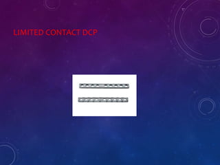 LIMITED CONTACT DCP
 