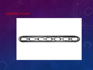 LOCKING PLATE
 