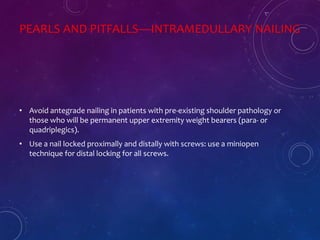 PEARLS AND PITFALLS—INTRAMEDULLARY NAILING
• Avoid antegrade nailing in patients with pre-existing shoulder pathology or
those who will be permanent upper extremity weight bearers (para- or
quadriplegics).
• Use a nail locked proximally and distally with screws: use a miniopen
technique for distal locking for all screws.
 