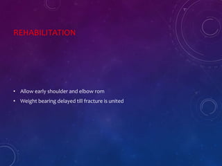 REHABILITATION
• Allow early shoulder and elbow rom
• Weight bearing delayed till fracture is united
 