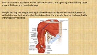 Muscle:Industrial accidents, motor vehicle accidents, and open injuries will likely cause
more soft tissue and muscle damage
Weight Bearing :No weight bearing is allowed until an adequate callus has formed or,
with plates, until primary healing has taken place. Early weight bearing is allowed with
intramedullary rodding.
 