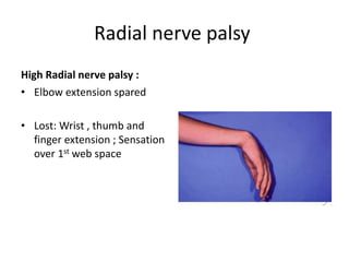 Radial nerve palsy
High Radial nerve palsy :
• Elbow extension spared
• Lost: Wrist , thumb and
finger extension ; Sensation
over 1st web space
 