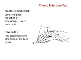 Radial nerve function test:
( pre- and post-
reduction )
assessment is very
important.
How to do ?
- by assessing active
extension of the MCP
joints.
 