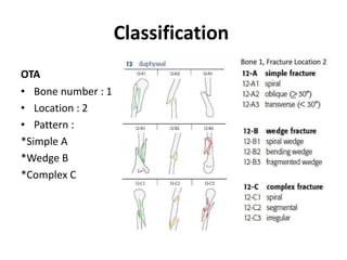 Classification
OTA
• Bone number : 1
• Location : 2
• Pattern :
*Simple A
*Wedge B
*Complex C
 