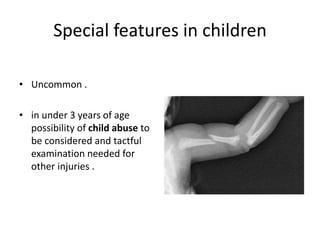Special features in children
• Uncommon .
• in under 3 years of age
possibility of child abuse to
be considered and tactful
examination needed for
other injuries .
 