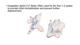 Comprehensive Overview of Humerus Shaft Fracture Management and ...