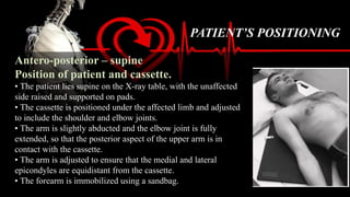 Basic Views Humerus X-Ray: Basic Views, Positioning, Technique, and Evaluation for ...