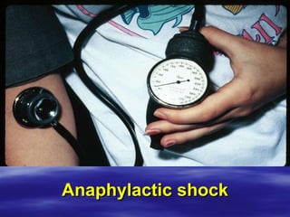 Anaphylactic shock 