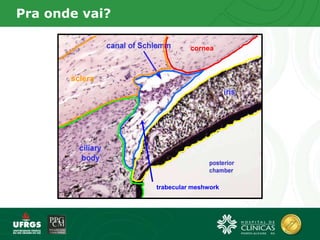 Pra onde vai?
sclera
cornea
trabecular meshwork
 