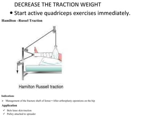 Comprehensive Principles and Techniques of Orthopaedic Traction | PDF