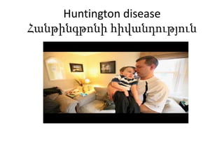 Huntington disease
Հանթինգթոնի հիվանդություն
 