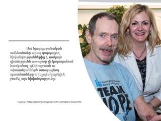 Սա նյարդաբանական
ամենածանր արագ զարգացող
հիվանդություններից է, սակայն
գիտությունն առ այսօր չի կարողանում
հասկանալ գենի արատն ու
ախտանշաններն առաջացնող
պատճառները և ինչպես կարելի է
բուժել այս հիվանդությունը:
Աղբյուր.՝ https://pixshark.com/people-with-huntingtons-disease.htm
 