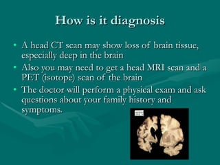 How is it diagnosis A head CT scan may show loss of brain tissue, especially deep in the brain  Also you may need to get a head MRI scan and a PET (isotope) scan of the brain  The doctor will perform a physical exam and ask questions about your family history and symptoms.  