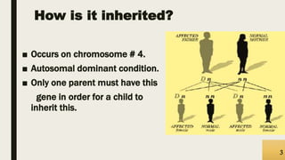 How is it inherited?
■ Occurs on chromosome # 4.
■ Autosomal dominant condition.
■ Only one parent must have this
gene in order for a child to
inherit this.
3
 