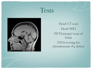 Tests
           Head CT scan
            Head MRI
        PET(isotope) scan of
               brain
       DNA testing for
    chromosome #4 defect
 