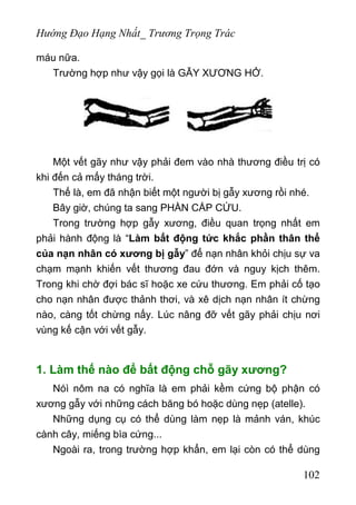 Hướng Đạo Hạng Nhất_ Trương Trọng Trác
máu nữa.
Trường hợp như vậy gọi là GẪY XƯƠNG HỞ.
Một vết gãy như vậy phải đem vào nhà thương điều trị có
khi đến cả mấy tháng trời.
Thế là, em đã nhận biết một người bị gẫy xương rồi nhé.
Bây giờ, chúng ta sang PHẦN CẤP CỨU.
Trong trường hợp gẫy xương, điều quan trọng nhất em
phải hành động là “Làm bất động tức khắc phần thân thể
của nạn nhân có xương bị gẫy” để nạn nhân khỏi chịu sự va
chạm mạnh khiến vết thương đau đớn và nguy kịch thêm.
Trong khi chờ đợi bác sĩ hoặc xe cứu thương. Em phải cố tạo
cho nạn nhân được thảnh thơi, và xê dịch nạn nhân ít chừng
nào, càng tốt chừng nấy. Lúc nâng đỡ vết gãy phải chịu nơi
vùng kế cận với vết gẫy.
1. Làm thế nào để bất động chỗ gãy xương?
Nóì nôm na có nghĩa là em phải kềm cứng bộ phận có
xương gẫy với những cách băng bó hoặc dùng nẹp (atelle).
Những dụng cụ có thể dùng làm nẹp là mảnh ván, khúc
cành cây, miếng bìa cứng...
Ngoài ra, trong trường hợp khẩn, em lại còn có thể dùng
102
 
