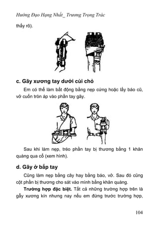 Hướng Đạo Hạng Nhất_ Trương Trọng Trác
thấy rõ).
c. Gãy xương tay dưới cùi chỏ
Em có thể làm bất động bằng nẹp cứng hoặc lấy báo cũ,
vở cuốn tròn áp vào phần tay gãy.
Sau khi làm nẹp, tréo phần tay bị thương bằng 1 khăn
quàng qua cổ (xem hình).
d. Gãy ở bắp tay
Cũng làm nẹp bằng cây hay bằng báo, vở. Sau đó cũng
cột phần bị thương cho sát vào mình bằng khăn quàng.
Trường hợp đặc biệt. Tất cả những trường hợp trên là
gẫy xương kín nhưng nay nếu em đứng trước trường hợp,
104
 