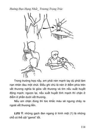 Hướng Đạo Hạng Nhất_ Trương Trọng Trác
Trong trường hợp nầy, em phải nén mạnh tay dù phải làm
nạn nhân đau một chút. Điều ghi chú là nén ở điểm phía trên
vết thương nghĩa là giữa vết thương và tim nếu xuất huyết
động mạch; ngược lại, nếu xuất huyết tĩnh mạch thì chặn ở
điểm ở phần dưới vết thương.
Nếu em chặn đúng thì tức khắc máu sẽ ngưng chảy ra
ngoài vết thương liền.
LƯU Ý: những gạch đen ngang ở hình một (1) là những
chỗ có thể cột “garrot” tốt.
114
 