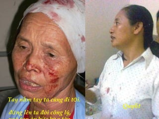 Tay n m tay ta cùng đi t i.ắ ớ
Quy tế
đ ng lên ta đòi công lý,ứ
 