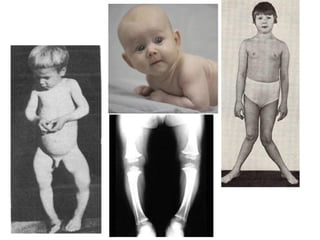 проф. С.Сэдэддулам, Сувилахуйн
тэнхим. УБДС

 