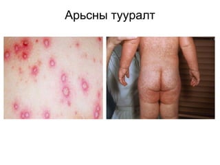 Арьсны тууралт

 