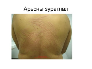 Арьсны зураглал

 