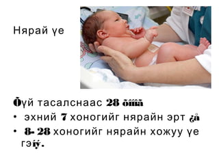 Нярай үе

Õүй тасалснаас 28 õîíîã
• эхний 7 хоногийг нярайн эрт ¿å
• 8- 28 хоногийг нярайн хожуу үе
гэ íý.

 