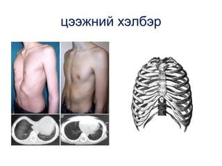 цээжний хэлбэр

 