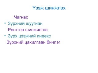 Үзэж шинжлэх
Чагнах
• Зүрхний шуугиан
Рентген шинжилгээ
• Зүрх цээжний индекс
Зүрхний цахилгаан бичлэг

 