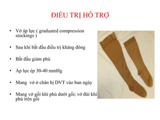 ĐIỀU TRỊ HỖ TRỢ
• Vớ áp lực ( graduated compression
stockings )
• Sau khi bắt đầu điều trị kháng đông
• Bắt đầu giảm phù
• Áp lực ép 30-40 mmHg
• Mang vớ ở chân bị DVT vào ban ngày
• Mang vớ gối khi phù dưới gối; vớ đùi khi
phù trên gối
 