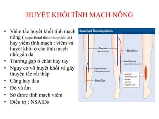 HUYẾT KHỐI TĨNH MẠCH NÔNG
• Viêm tắc huyết khối tĩnh mạch
nông ( superficial thrombophlebitis)
hay viêm tĩnh mạch : viêm và
huyết khối ở các tĩnh mạch
nhỏ gần da
• Thường gặp ở chân hay tay
• Nguy cơ vỡ huyết khối và gây
thuyên tắc rất thấp
• Căng hay đau
• Đỏ và ấm
• Sờ được tĩnh mạch viêm
• Điều trị : NSAIDs
 
