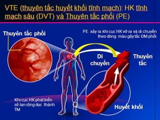 Huyet khoi tinh_mach_chi
