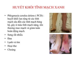 HUYẾT KHỐI TĨNH MẠCH XANH
• Phlegmasia cerulea dolens ( PCD) :
huyết khối lan rộng từ các tĩnh
mạch sâu đến các tĩnh mạch bàng
hệ, gây ứ máu tĩnh mạch nặng, tổn
thương mao mạch và giảm tuần
hoàn động mạch.
• Sưng rất nhiều
• Đau
• Lạnh và tím
• Hoại thư
• Choáng
 