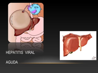 HEPATITIS VIRAL

AGUDA
 
