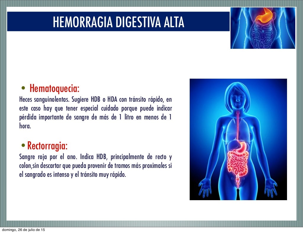 Hemorragia Digestiva Alta 2015 Hemorragia Digestiva Alta 2015