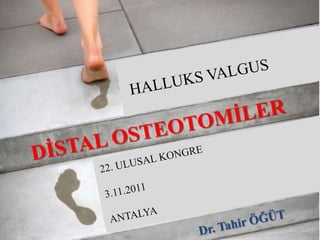 7 Kasım 2009,Çeşme




KALKANEUS KIRIKLARININ
CERRAHİ TEDAVİSİ




                                         Dr. Tahir ÖĞÜT


İstanbul Üniversitesi
Cerrahpaşa Tıp Fakültesi
Ortopedi ve Travmatoloji Anabilim Dalı
 
