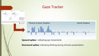 Gaze Tracker
Upward spikes: indicating eye movements
Downward spikes: indicating blinking during stimulus presentation.
 