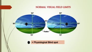 60
50 50
90 90
70 70
Fixation
X X
= Physiological Blind spot
X
NORMAL VISUAL FIELD LIMITS
 