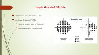 Generalized field defect in TDPP.
Localized defect in PDPP.
Found in advance stage of glaucoma.
Cataract associated with glaucoma
Irregular Generalized Field defect
 