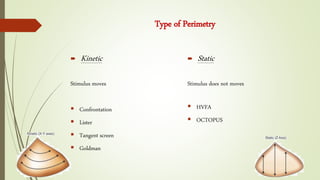  Kinetic
Stimulus moves
 Confrontation
 Lister
 Tangent screen
 Goldman
Type of Perimetry
 Static
Stimulus does not moves
 HVFA
 OCTOPUS
 
