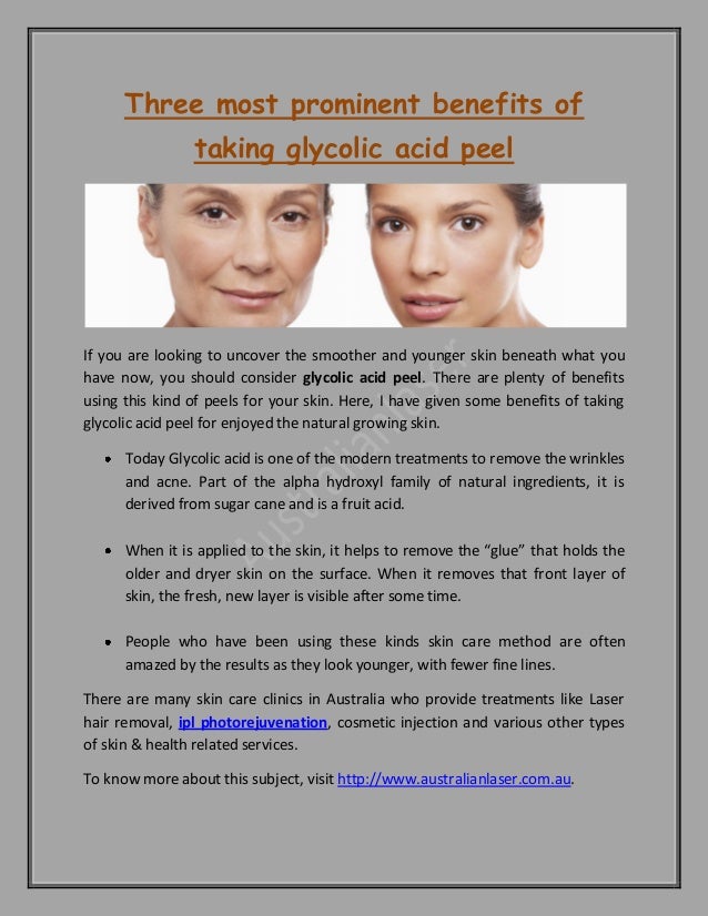 Three most prominent benefits of taking glycolic acid peel