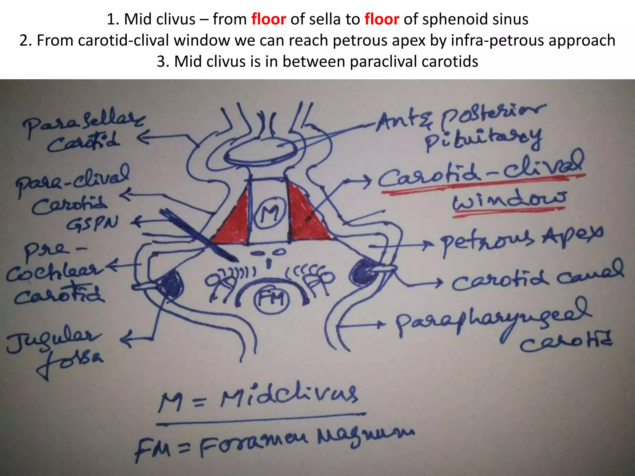 Endoscopic view with 45º lens after pituitary transposition. MB:
mammillary bodies; PCA: posterior cerebral artery; PCoA: posterior communicating
artery; SCA: superior cerebellar artery; VA: vertebral artery; III: third cranial nerve
 