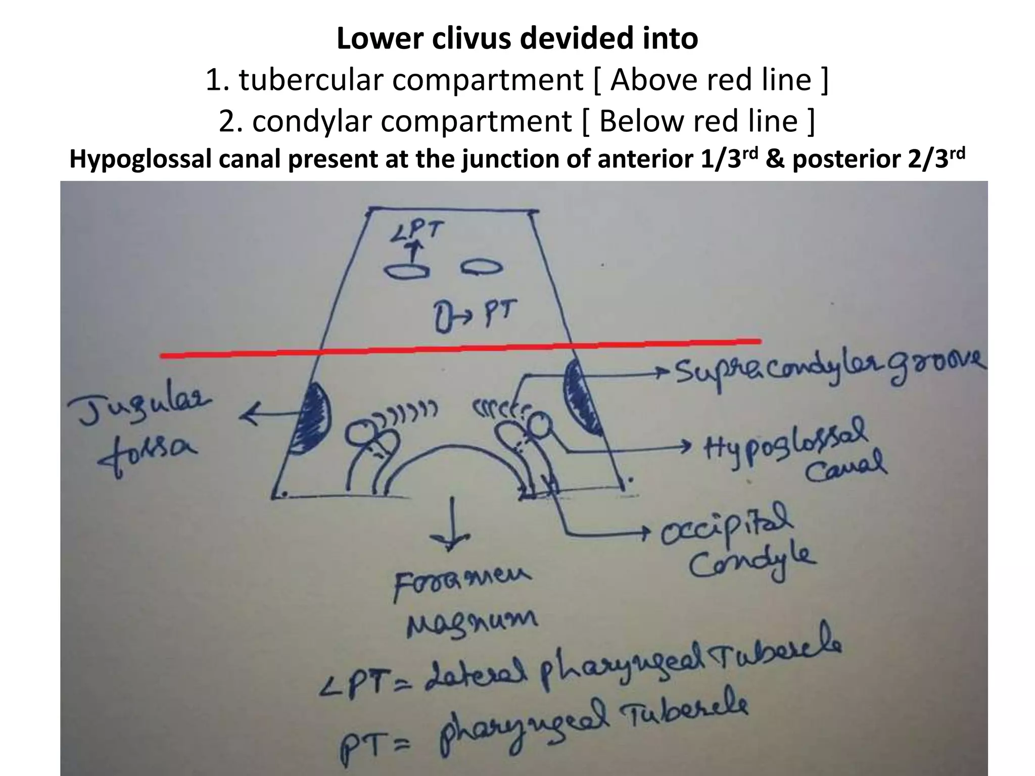 The tubercular compartment corresponds to the Jugular tubercle ( JT )
Line along the lateral pharyngeal tubercle [ LPT ] passes through
Jugular tubercle [ JT ] – so when you are drilling LPT in anterior skull
base you will land up on JT .
LPT lateral pharyngeal tubercle, OC
occipital condyle, PT pharyngeal
tubercle, SCG supracondylar groove
Jugular tubercle ( JT )
 