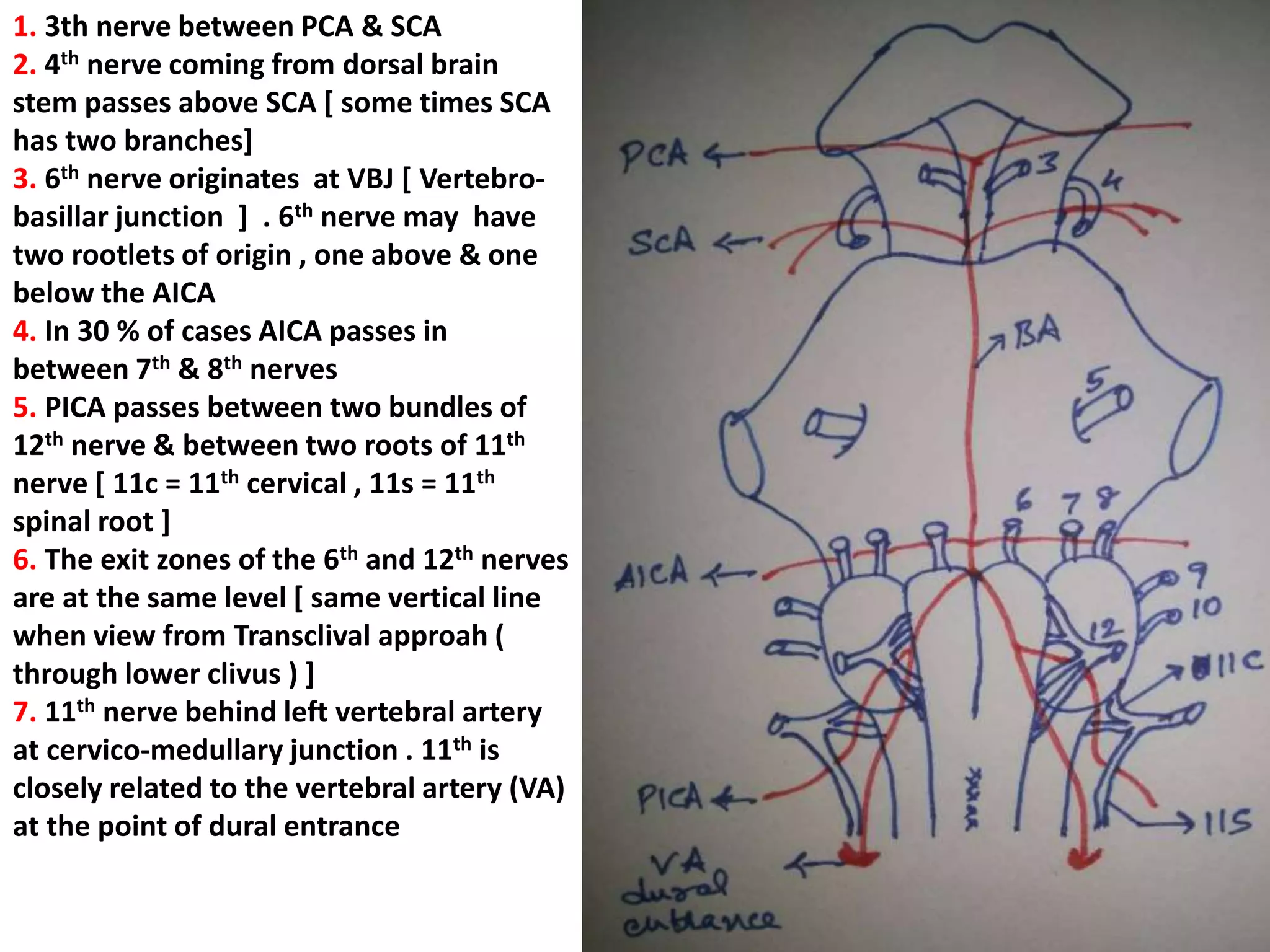Lower clivus + petrous bone [ base ] + Zygomatic bone
Petrous bone devided
into three 1/3rds
 