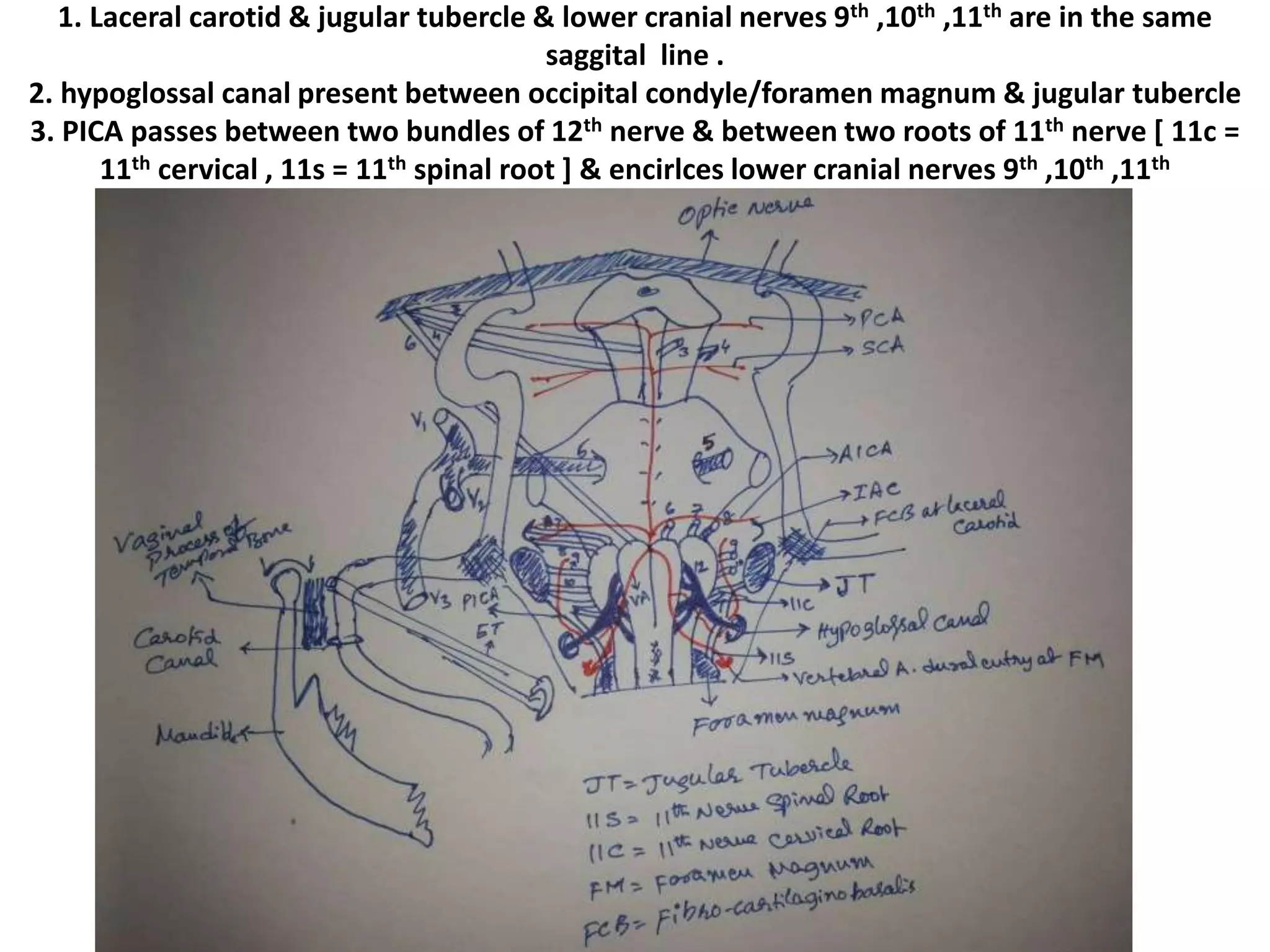 ICA Vertebro-basillar
 