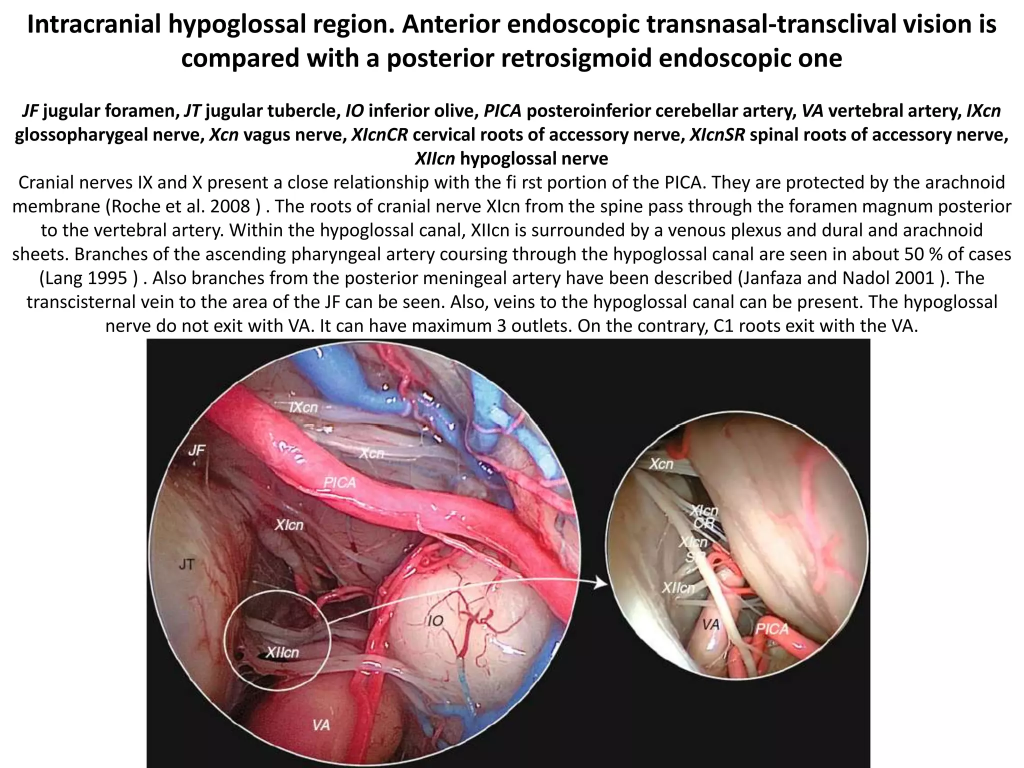 Hypoglossal is just behind the upper end of
parapharyngel carotid – very easy way to
identify 12th nerve in paraphayrngeal space
– Dr.Satish jain
 