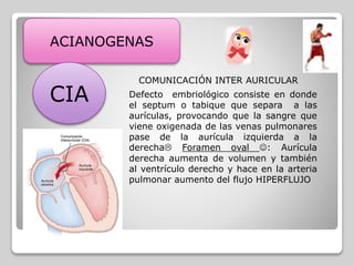 ACIANOGENAS
CIA
COMUNICACIÓN INTER AURICULAR
Defecto embriológico consiste en donde
el septum o tabique que separa a las
aurículas, provocando que la sangre que
viene oxigenada de las venas pulmonares
pase de la aurícula izquierda a la
derecha Foramen oval : Aurícula
derecha aumenta de volumen y también
al ventrículo derecho y hace en la arteria
pulmonar aumento del flujo HIPERFLUJO
 