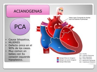 ACIANOGENAS
PCA
CONDUCTO ARTERIOSO PERSISTENTE
Consiste en la apertura persistente entre
la aorta y la arteria pulmonar, incapaz de
cerrarse en el momento del parto.
• Niños prematuros e infecciones por
Rubeola materna.. Sx Down.• Causa Idiopatica,
• MUJERES
• Defecto único en el
90% de los casos.
• Muy común en
bebes con Sx
corazón izquierdo
hipoplasico.
 
