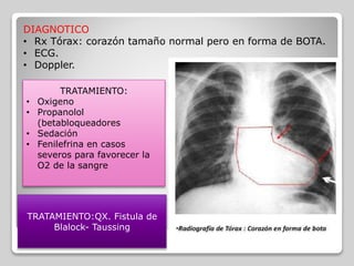 DIAGNOTICO
• Rx Tórax: corazón tamaño normal pero en forma de BOTA.
• ECG.
• Doppler.
TRATAMIENTO:
• Oxigeno
• Propanolol
(betabloqueadores
• Sedación
• Fenilefrina en casos
severos para favorecer la
O2 de la sangre
TRATAMIENTO:QX. Fistula de
Blalock- Taussing
 